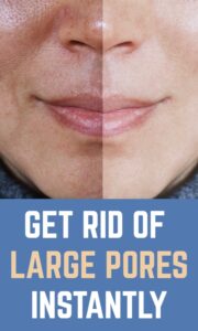 Get Rid of Large Pores Instantly