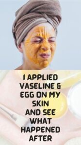 Vaseline and Egg White Mask for EVERYTHING